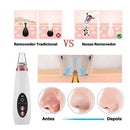 Removedor De Cravos Espinhas