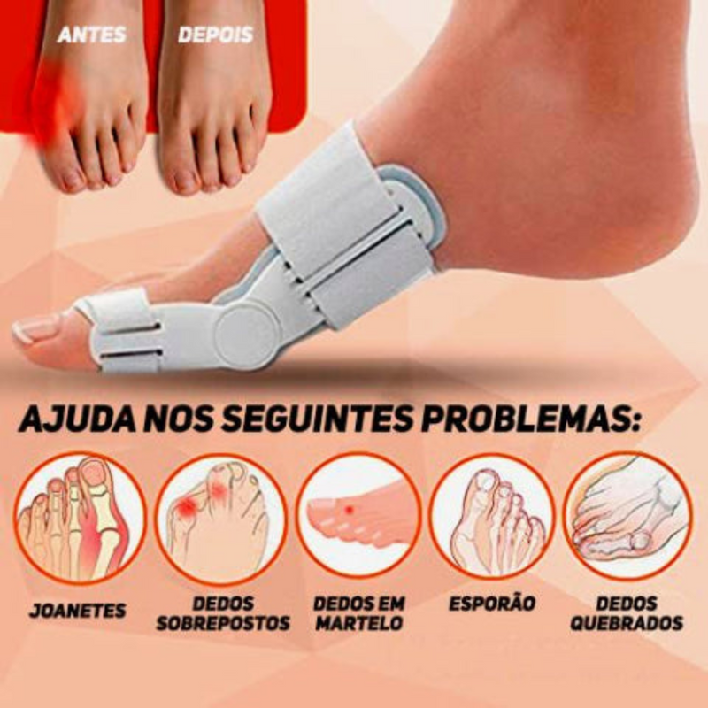 Corretor Ortopédico Articulado De Joanete - COMPRE 1 LEVE 2