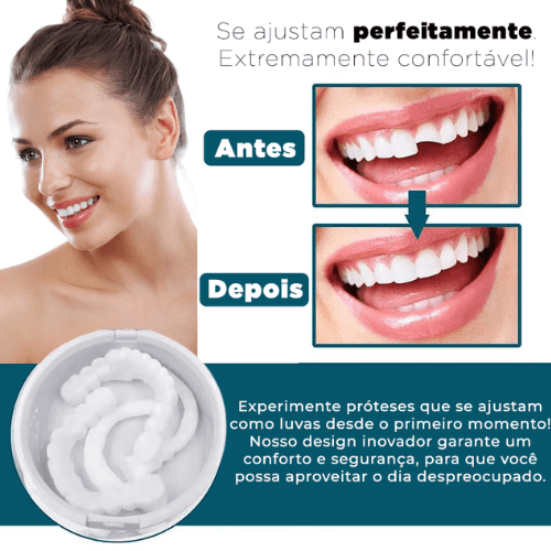 SmileWhite  - Par de Facetas Dentárias Naturais (MOLDE AJUSTÁVEL!)