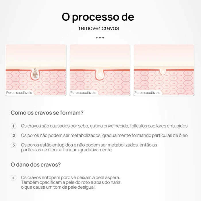 Removedor de Cravos Lanbena®
