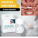 SmileWhite  - Par de Facetas Dentárias Naturais (MOLDE AJUSTÁVEL!)