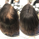 Topo De Cabeça (Cabelo Humano) - Para Alopecia, Falhas, Cabelos Ralos e com Queda